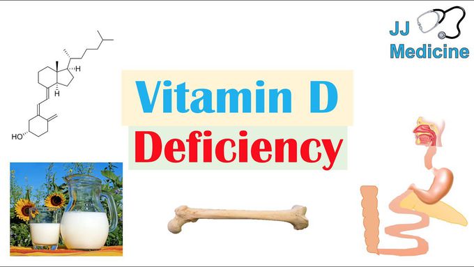 Vitamin D Deficiency | Introduction, Absorption & Metabolism, Purpose of Vit D, Causes of Deficiency