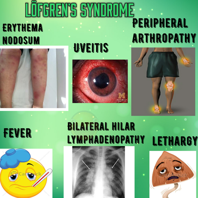 Löfgren's syndrome