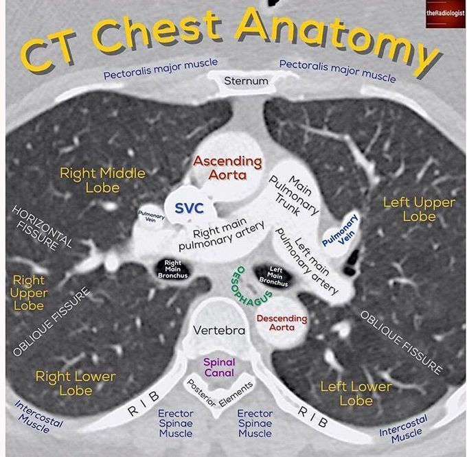 Chest ct