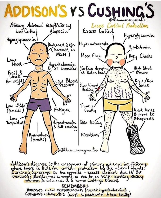 Addison's Vs Cushing's