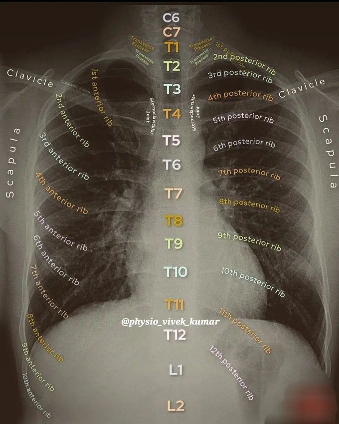 Transverse Process