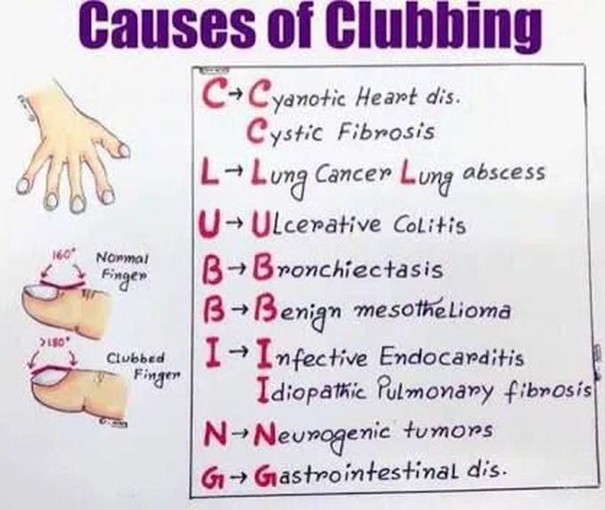 Causes of clubbing fingers