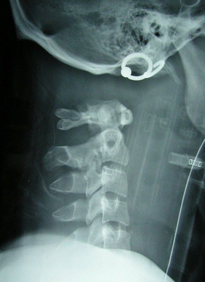 Radiology quiz