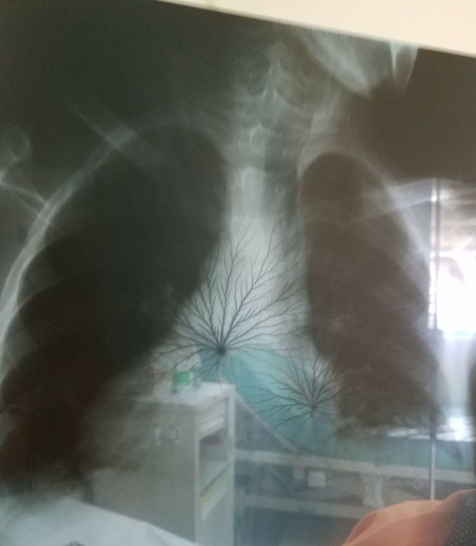 What do you see ?