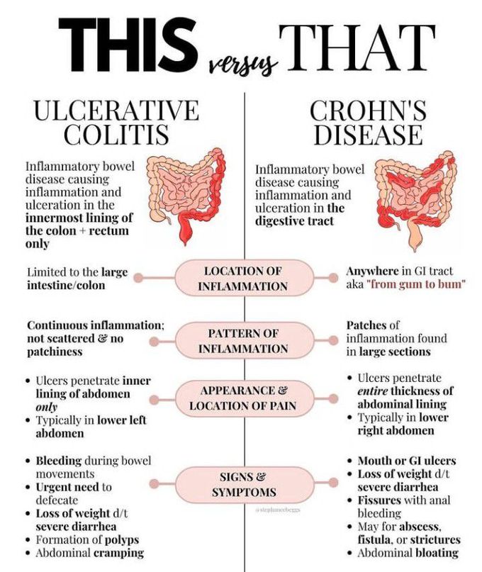 Ulcerative colitis vs crohns disease