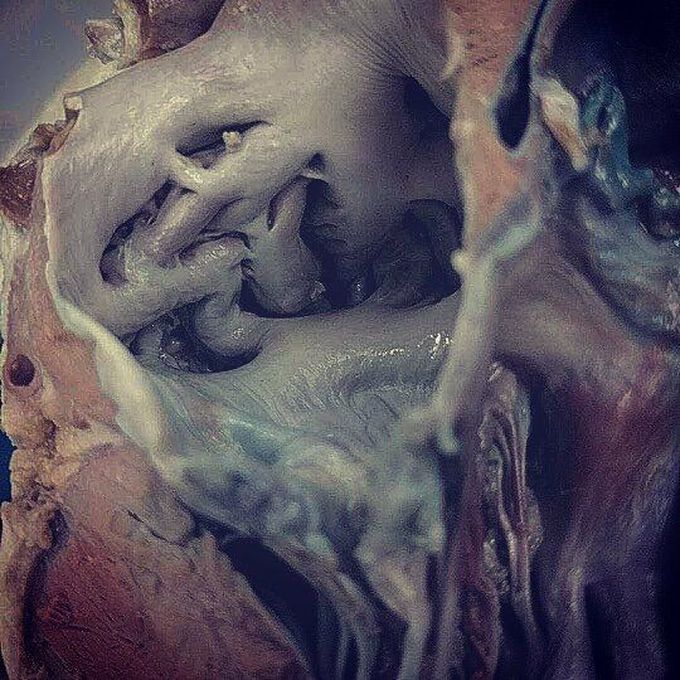 Inner look at a pig heart