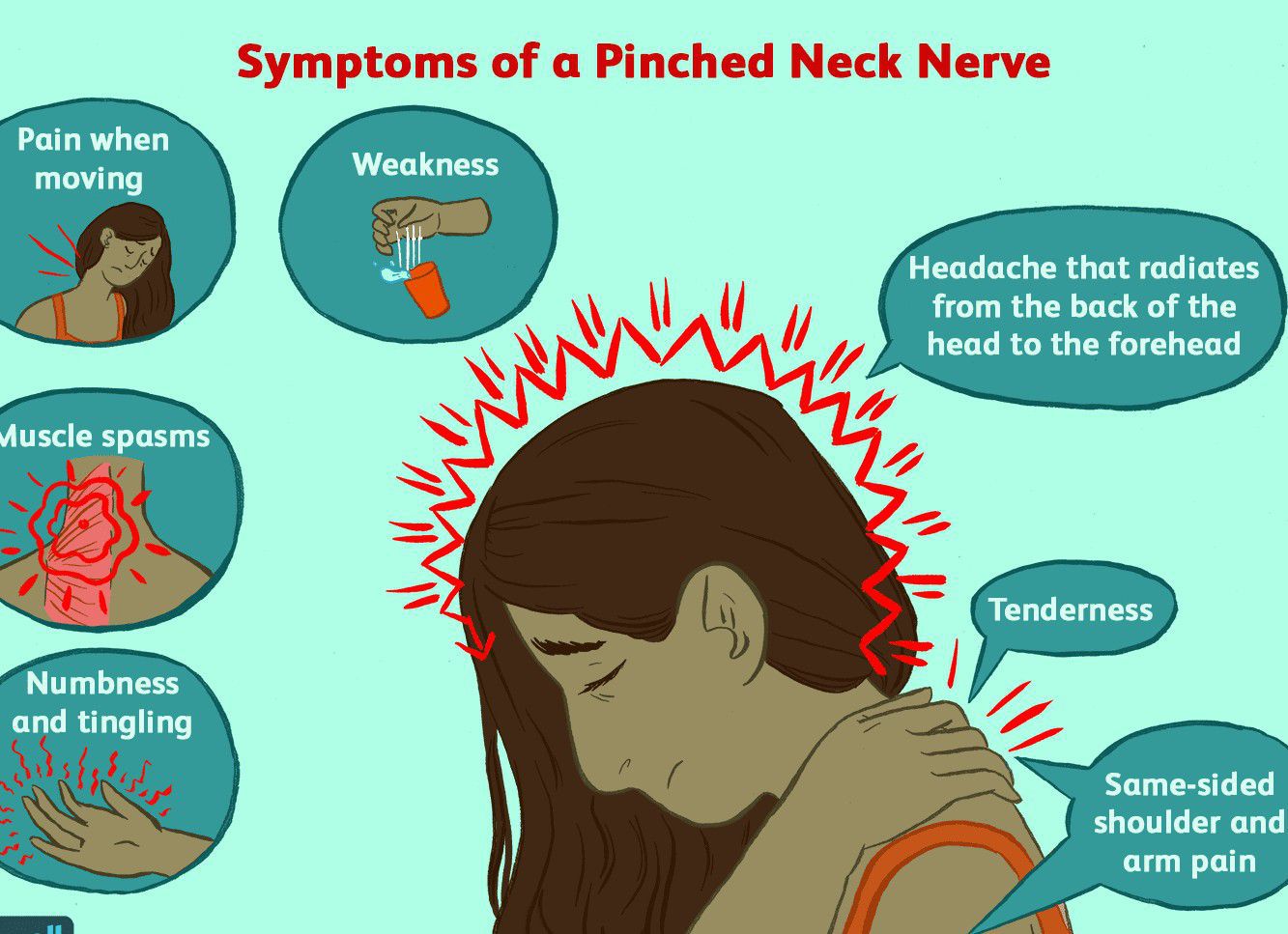 pinched-nerve-medizzy