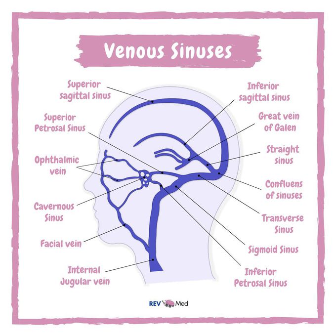 Dural Venous Sinuses