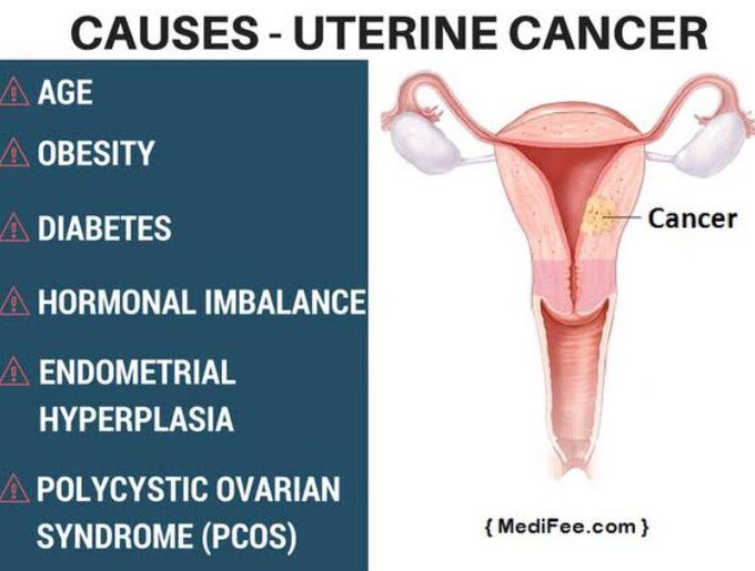 Cause of Uterine cancer