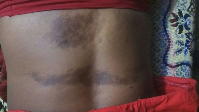 SkinSkin problems
