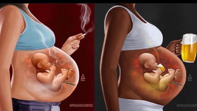 Prenatal exposure to smoking