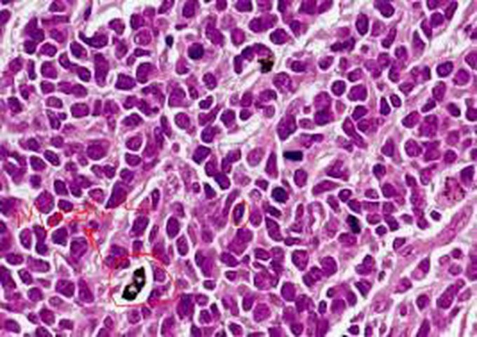 Kulchitsky cells