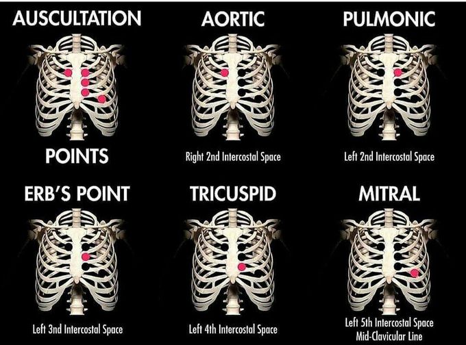 Auscultation Points