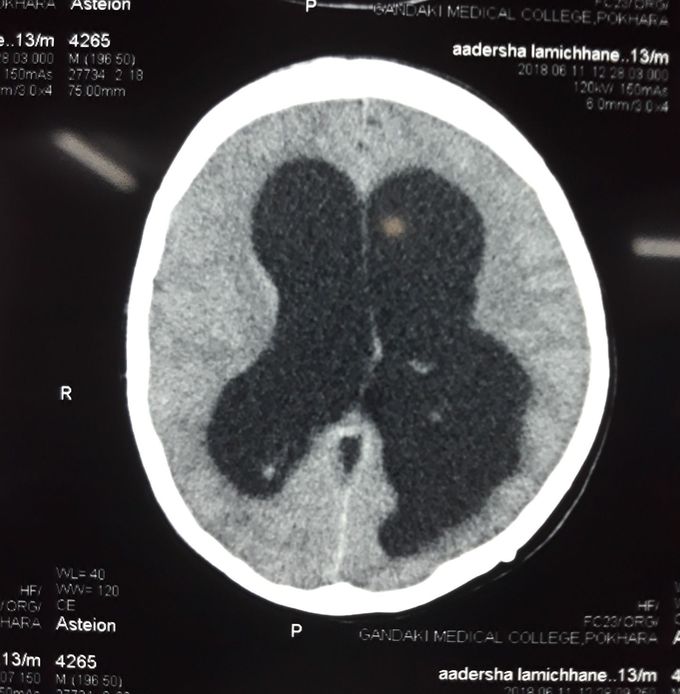 What is your diagnosis??