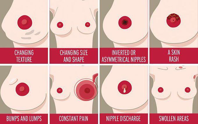 Warning signs of breast cancer