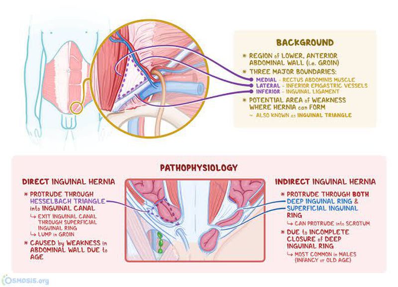Posterior Abdominal Wall Osmosis