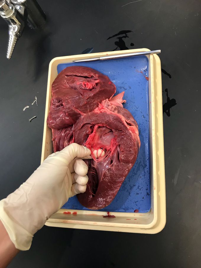 chordae tendineae❤️