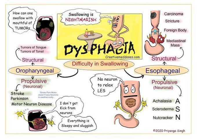 Causes of dysphagia