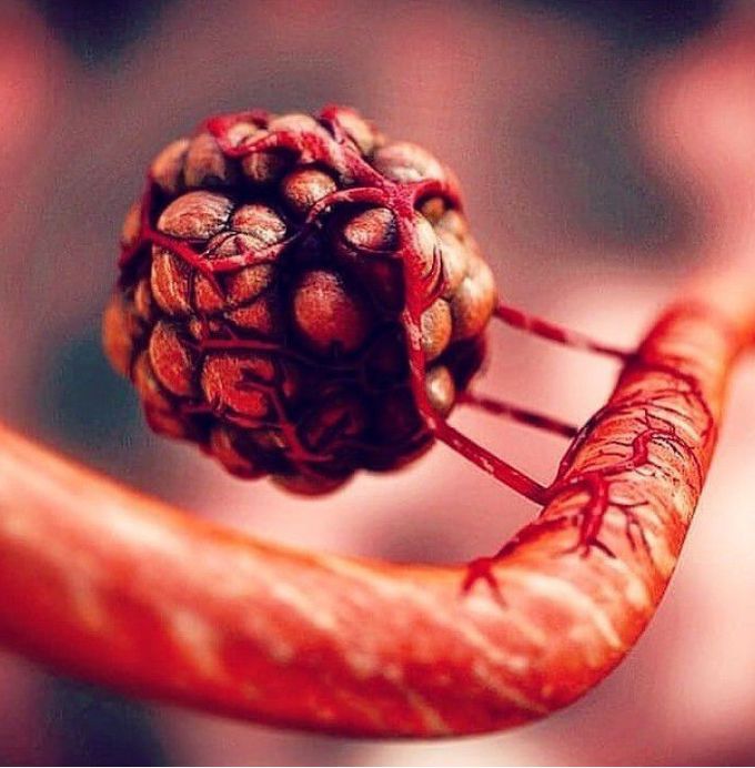 Angiogenesis of tumor cells