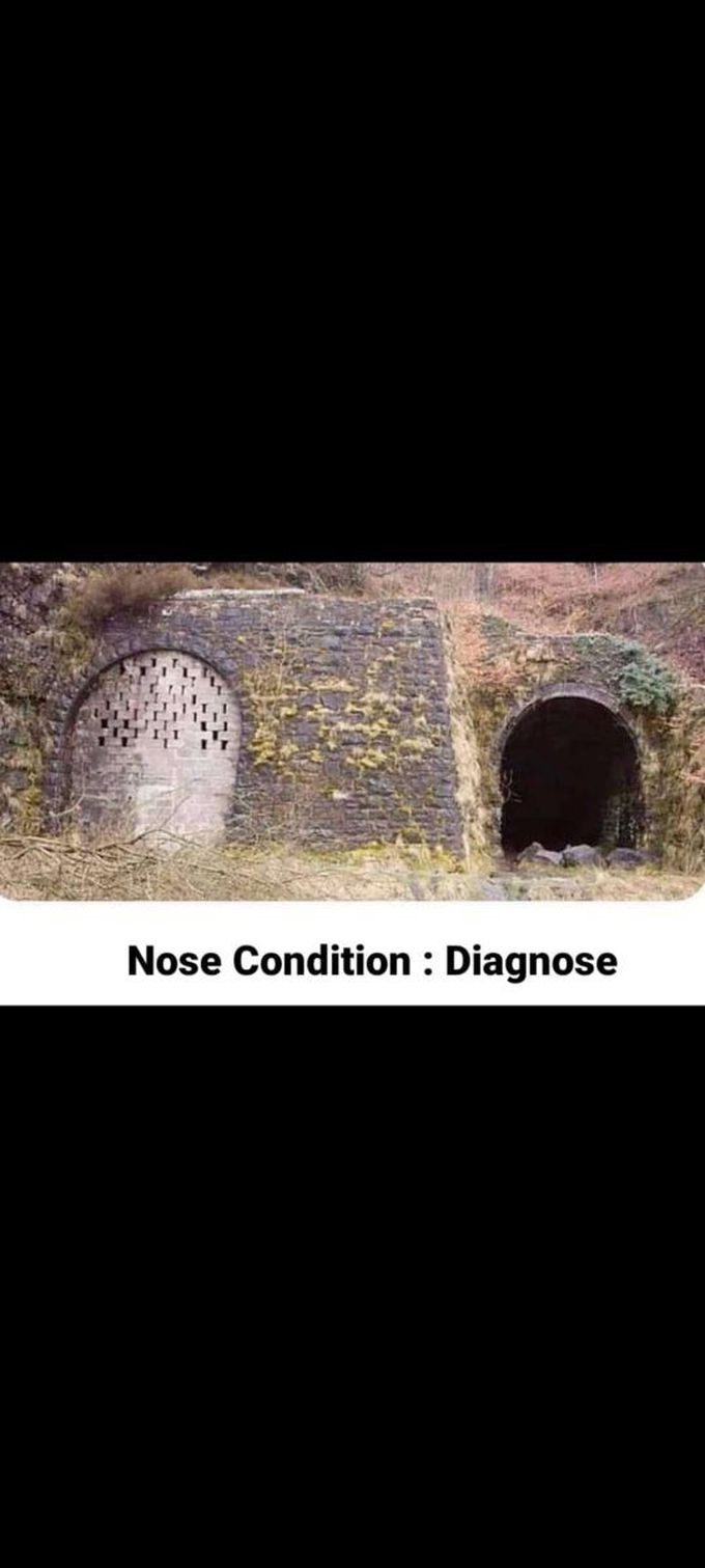 Dignosis nasal condition