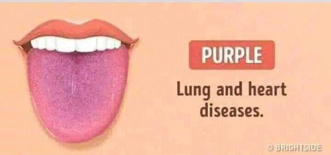 Lung diseased