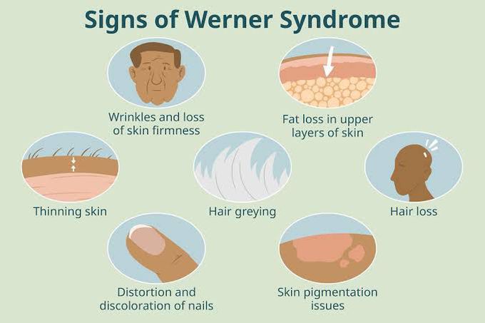 These are the symptoms of Werner syndrome