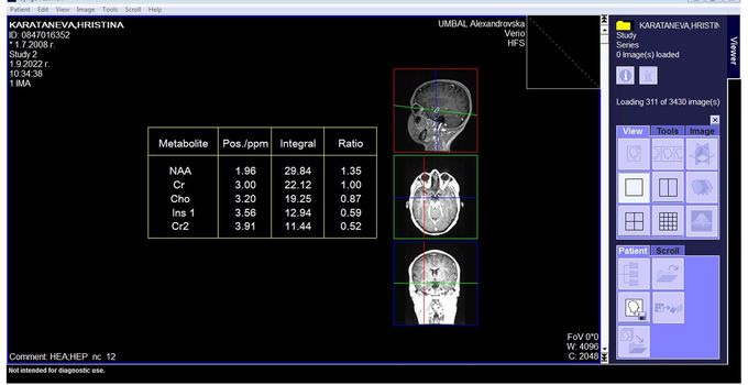 Help with MRI