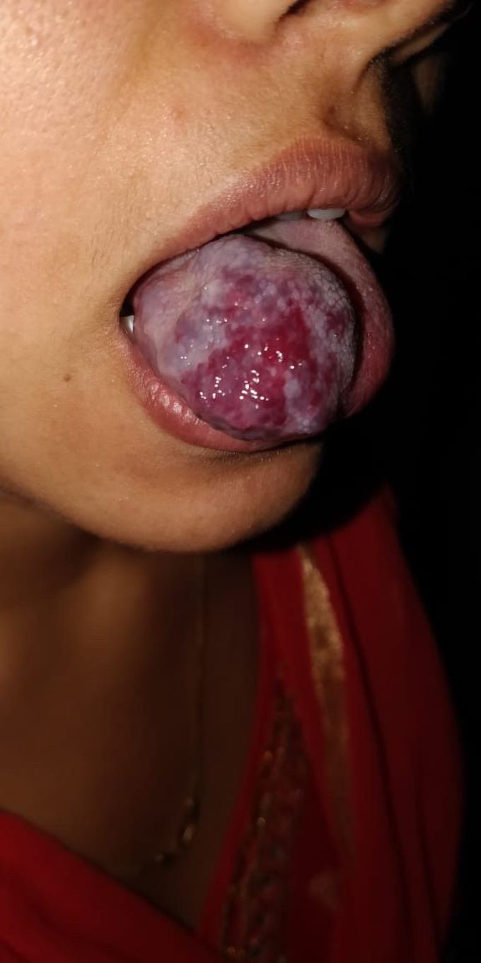 Can you guess the diagnosis ??