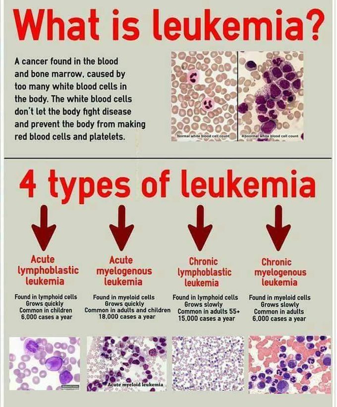 Leukaemia