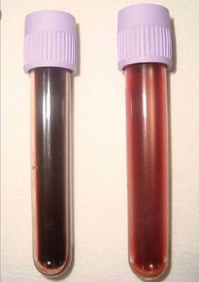 The vial on the left is classic example of deoxyenated blood