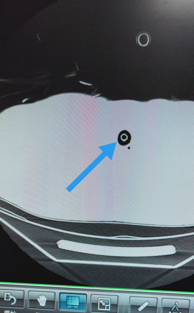Lung window CT