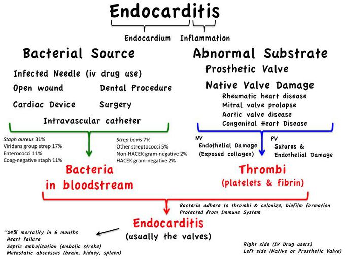 Endocarditis