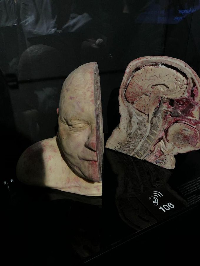 Human body