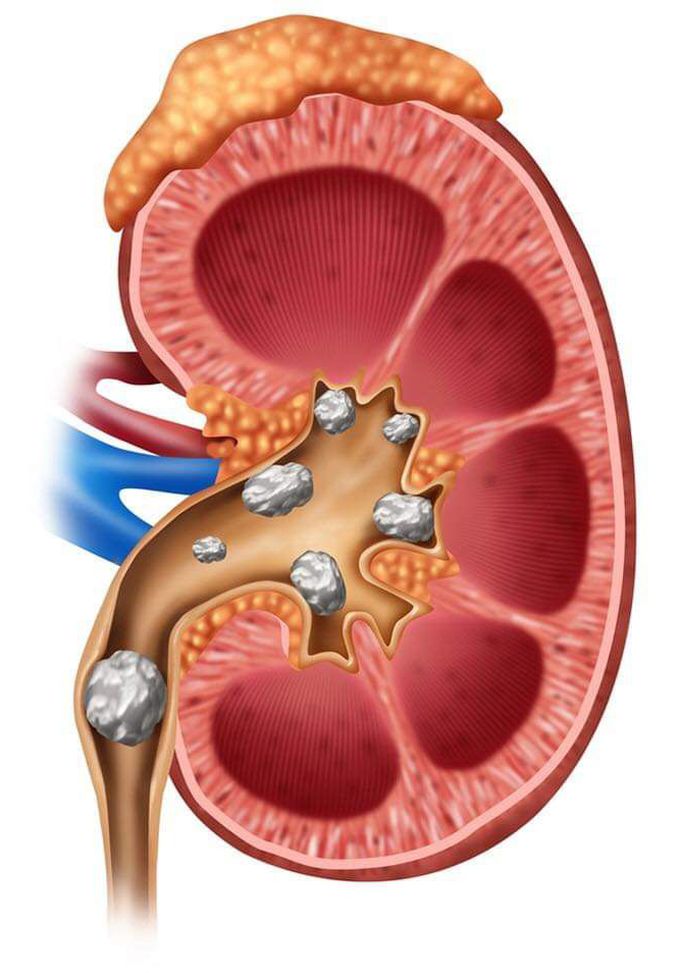 Kidney