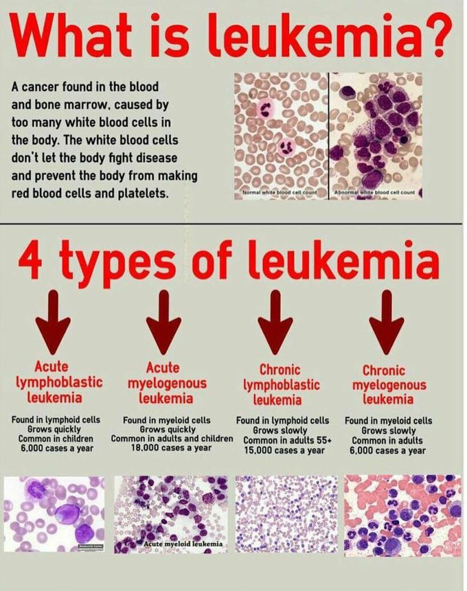 leukemia