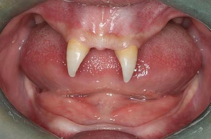 What is your diagnosis?