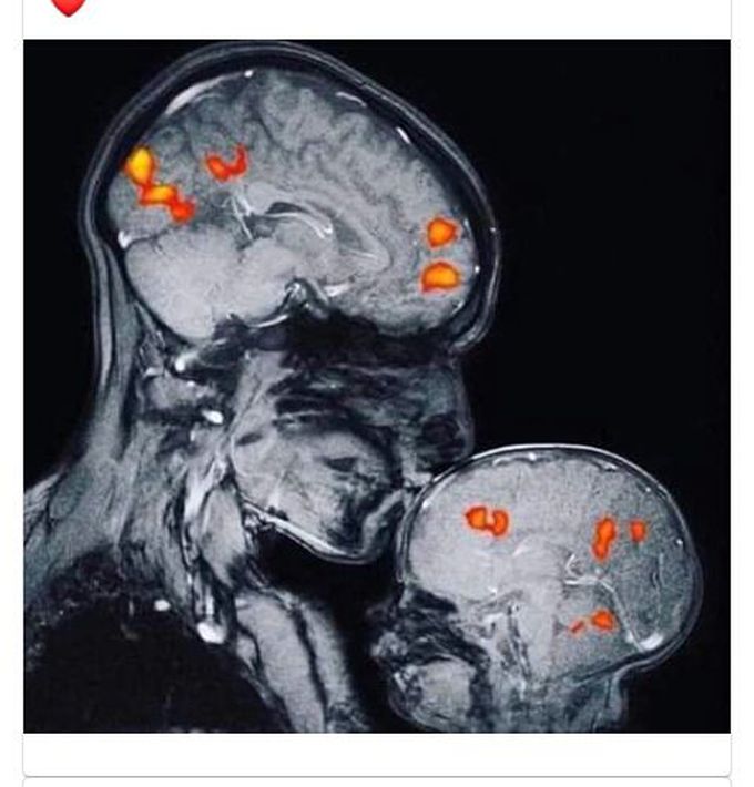 MRI of love 😍