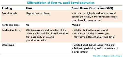 Ileus and Small Bowel Obstruction - MEDizzy