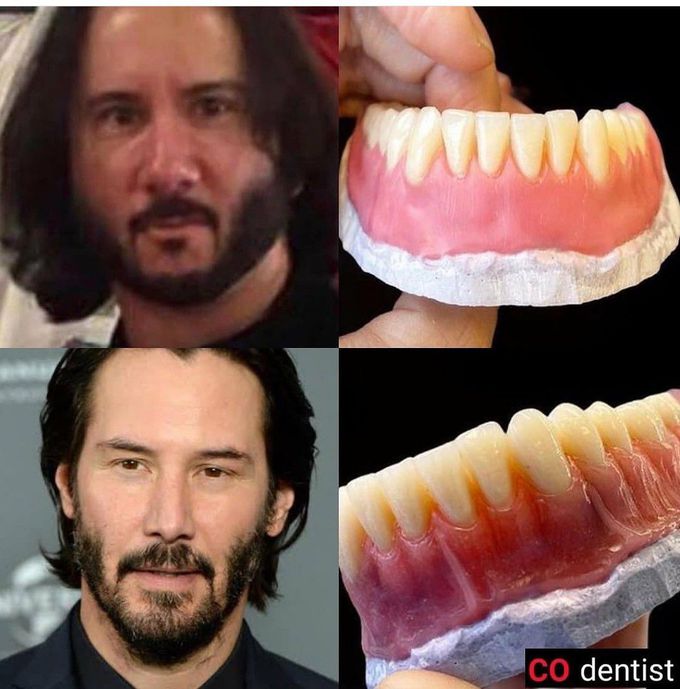 Teeth determine shape of face