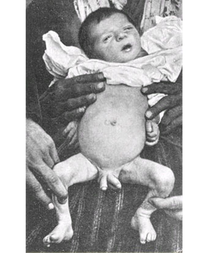 What's your diagnosis?