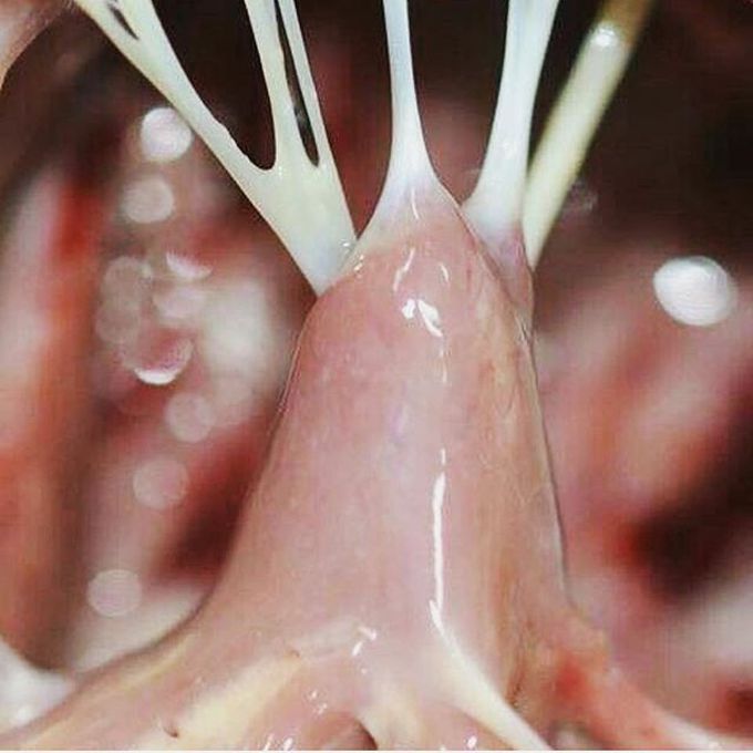 Closeup view of chordae tendinae