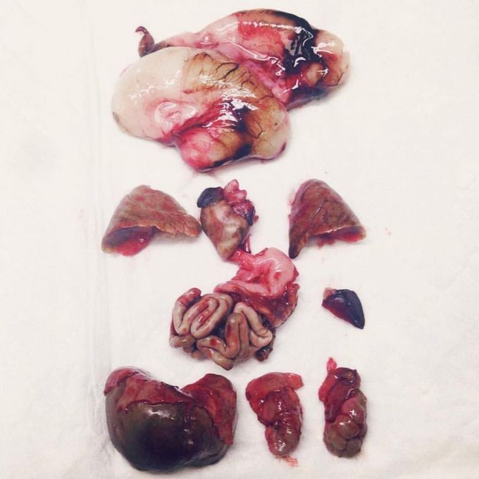Collection of fetal organs