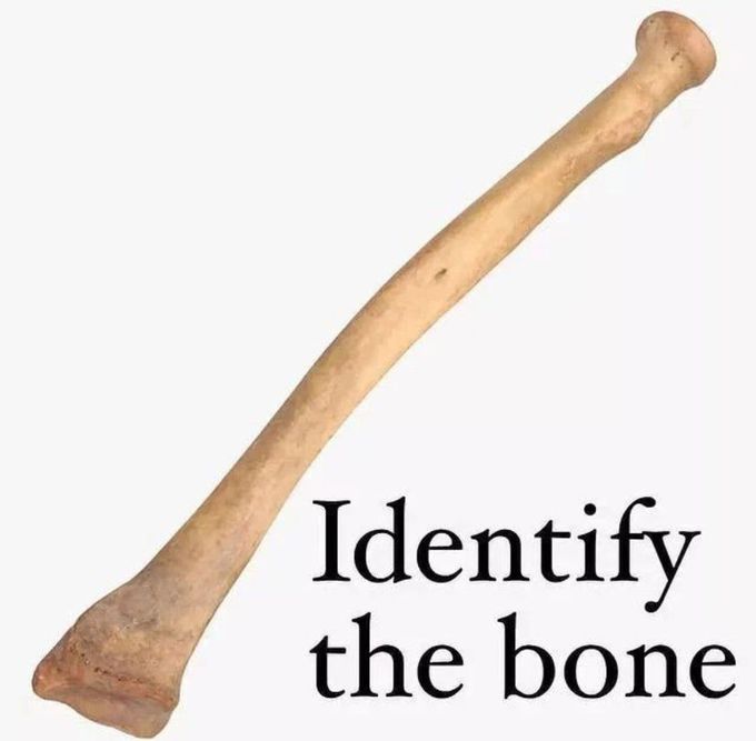 Identify the Bone