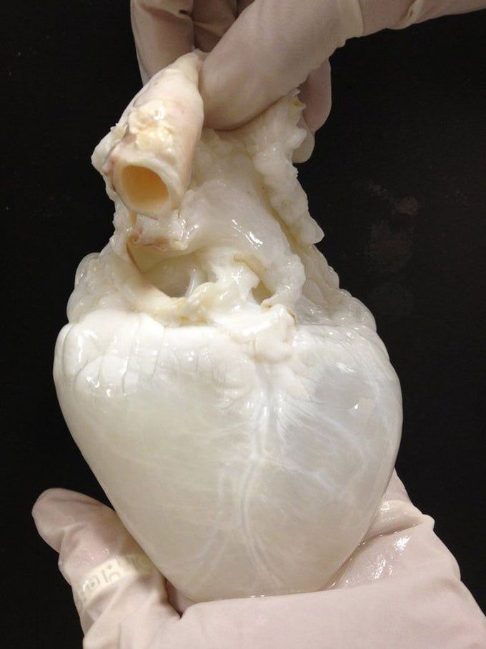 A Human Heart Without Blood In It. 😲