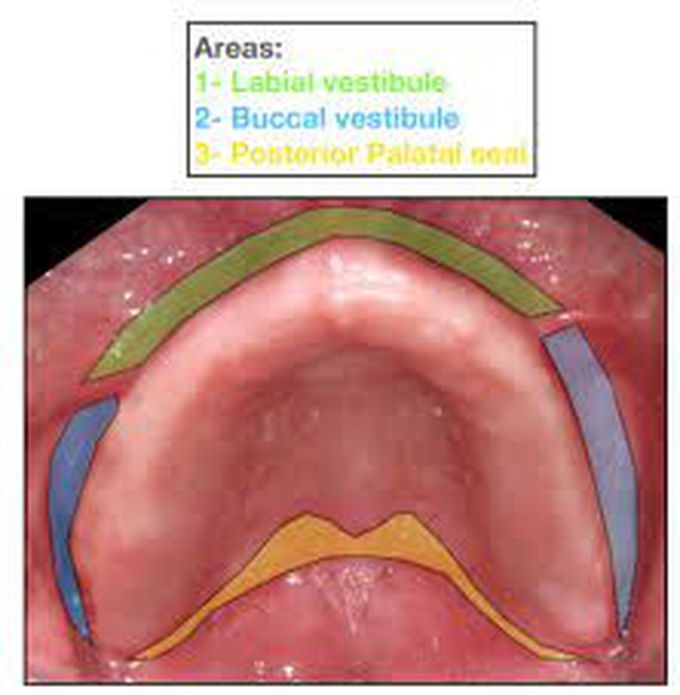 Labial vestibule