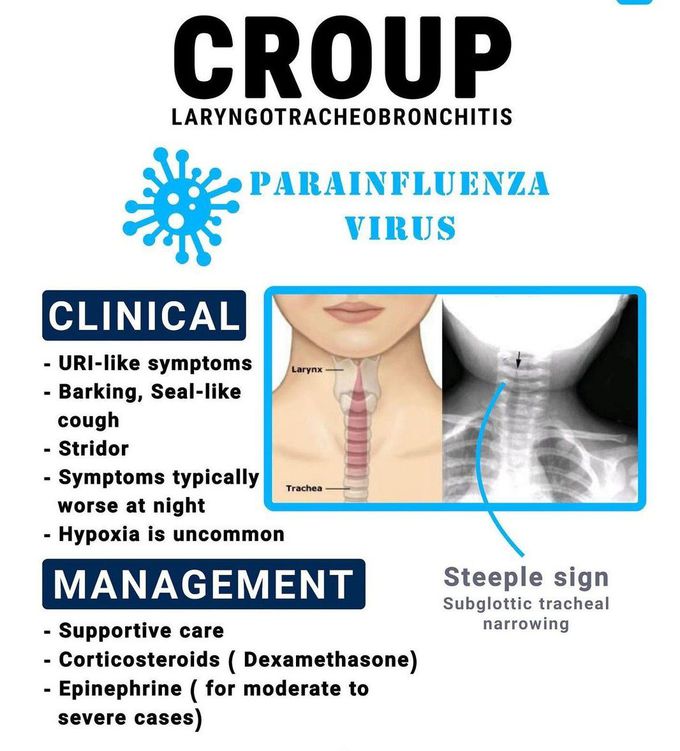 Croup