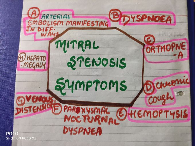 So, here are symptoms of mitral stenosis. Have a look on this.