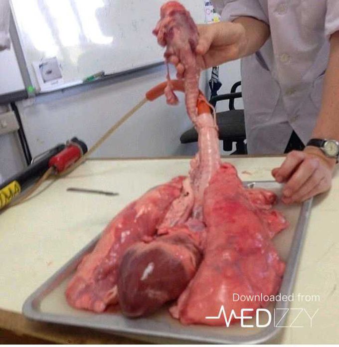 Heart and lungs