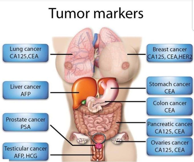 Lung - breast -liver -stomach -prostate -colon -pancreas - testicle- ovary.