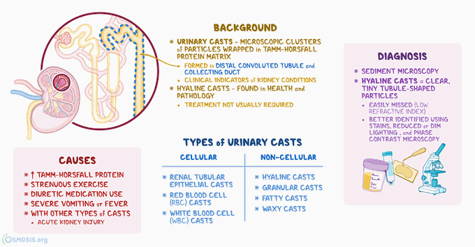 Urinary Casts